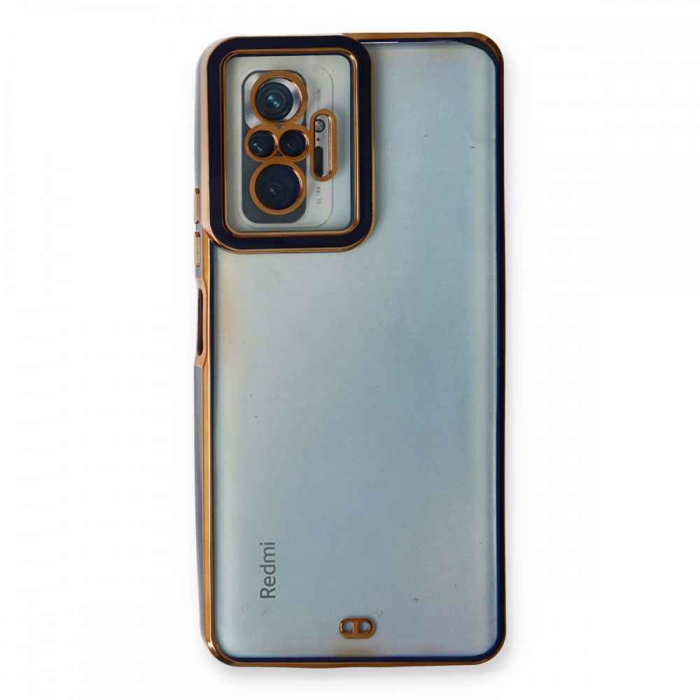 Xiaomi Redmi Note 10 Pro Kılıf | Newface Liva Lens Serisi | Özel Kamera Korumalı Soft Touch Darbe Emici Silikon Kapak | MobixMood