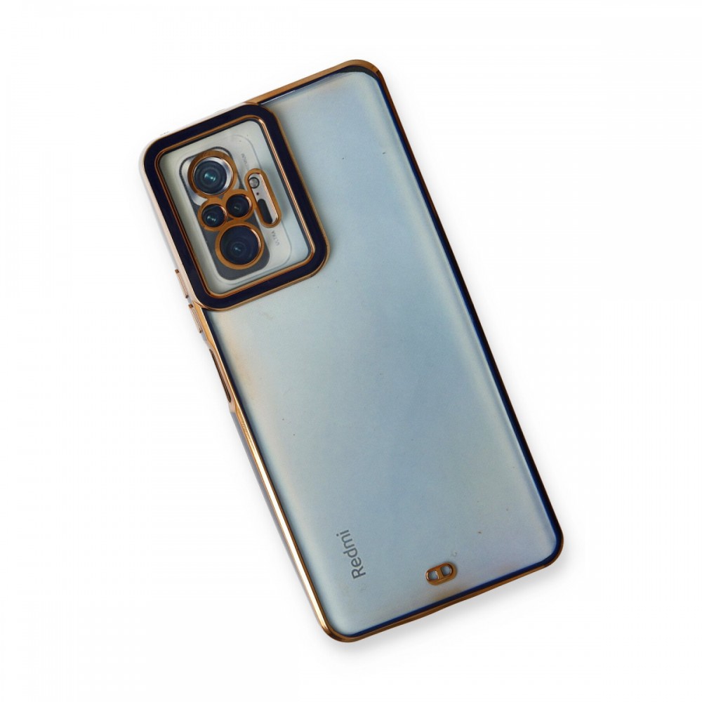 Xiaomi Redmi Note 10 Pro Newface Liva Lens kılıf özel kamera korumalı soft touch silikon darbe emici esnek koruyucu telefon kılıfı