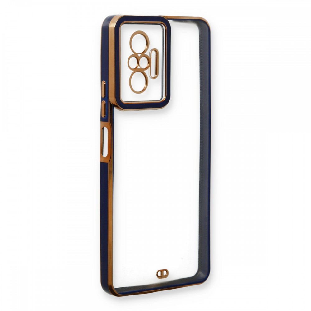 Xiaomi Redmi Note 10 Pro Newface Liva Lens kılıf özel kamera korumalı soft touch silikon darbe emici esnek koruyucu telefon kılıfı